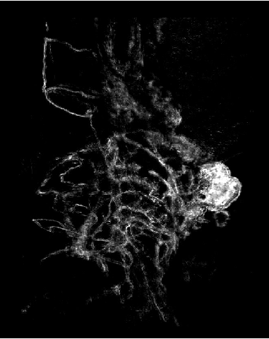 基于光片显微的激光散斑自相关成像